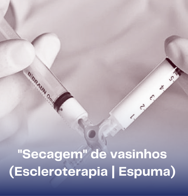 Secagem de vasinhos