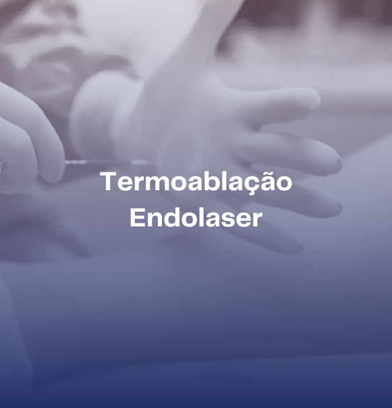 Termoablação Endolaser